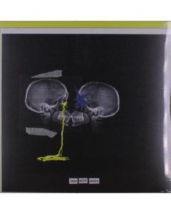 Nikra - Über beide Ohren (Yellow-Transparent White Vinyl) LP