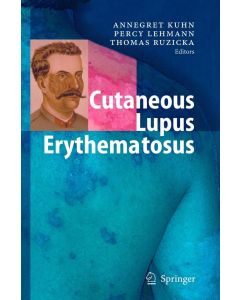 Cutaneous Lupus Erythematosus